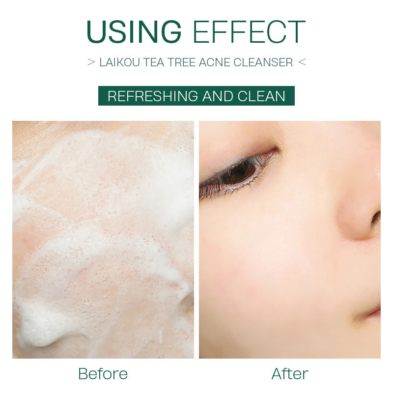VALORÉ Foundation: Tea Tree Detox Foam