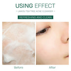 VALORÉ Foundation: Tea Tree Detox Foam