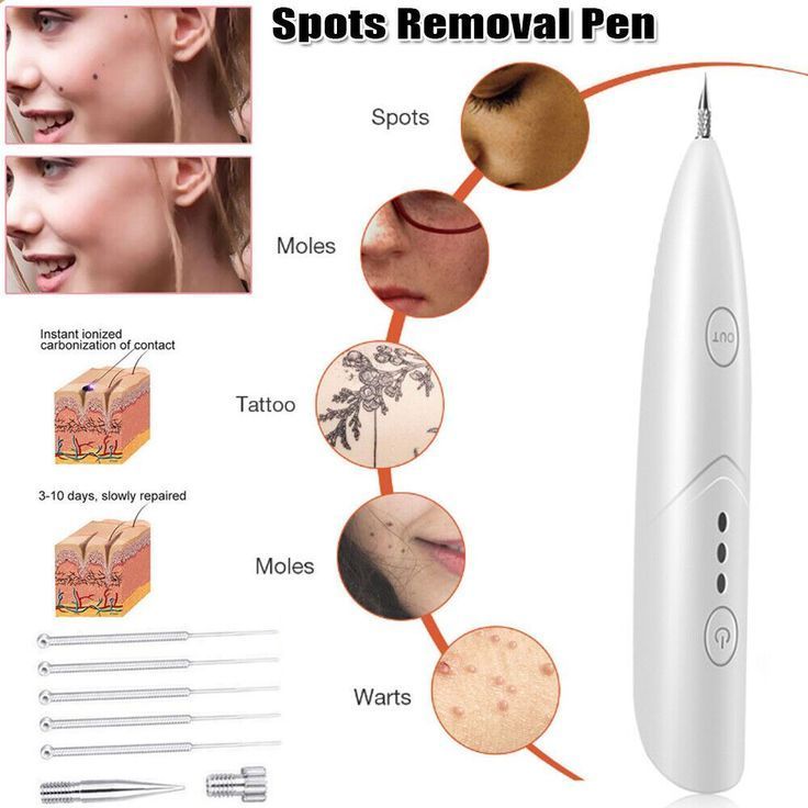 VALORÉ Derma - Fine Laser System
