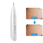 VALORÉ Derma - Fine Laser System