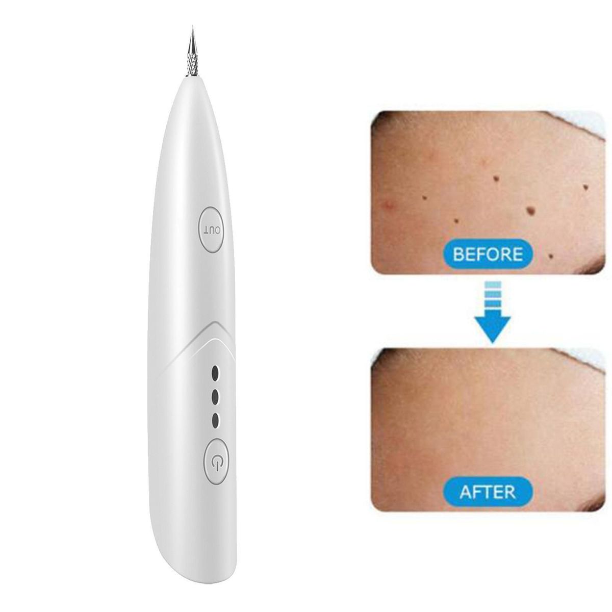 VALORÉ Derma - Fine Laser System
